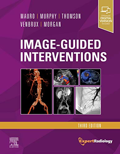 Image-Guided Interventions: Expert Radiology Series von Saunders