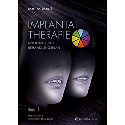 Implantattherapie: Der integrierte Behandlungsplan: Band I: Diagnostik und chirurgische Behandlung von Quintessenz Verlag
