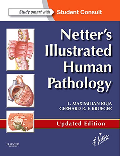 Netter's Illustrated Human Pathology Updated Edition: with Student Consult Access von Saunders