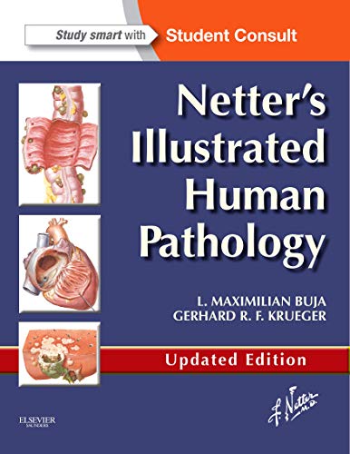 Netter's Illustrated Human Pathology Updated Edition: with Student Consult Access