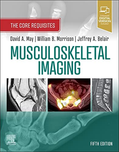 Musculoskeletal Imaging: The Core Requisites von Elsevier