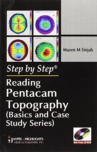 Reading Pentacam Topography (Step by Step: Basics and Case Study Series)