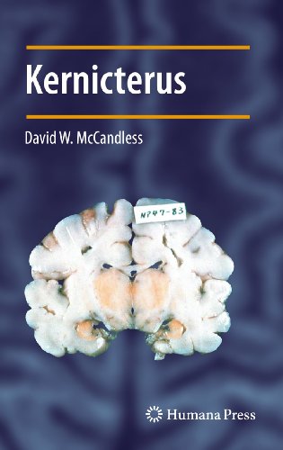 Kernicterus (Contemporary Clinical Neuroscience) von Humana
