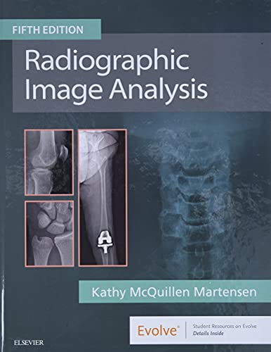 Radiographic Image Analysis von Saunders