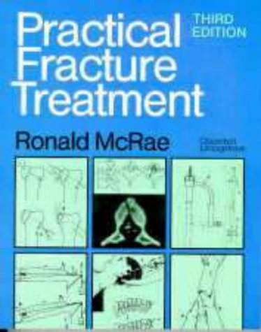 Practical Fracture Treatment