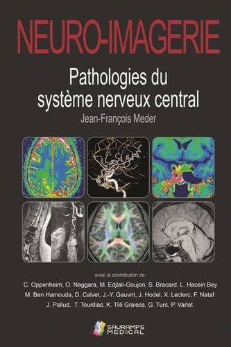 NEURO-IMAGERIE. PATHOLOGIES DU SYSTEME NERVEUX CENTRAL 2ED: Pathologies du système nerveux central von SAURAMPS MEDICA