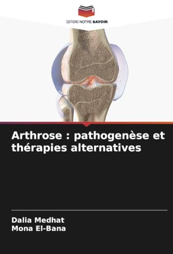Arthrose : pathogenèse et thérapies alternatives: DE von Editions Notre Savoir
