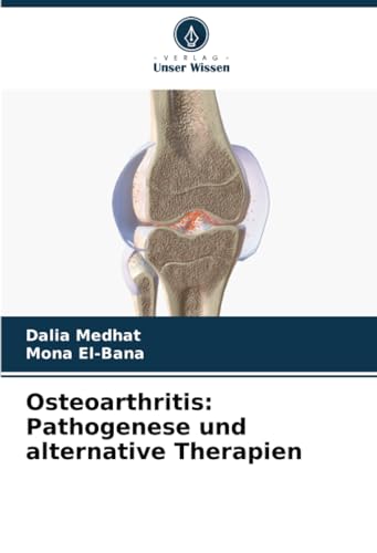 Osteoarthritis: Pathogenese und alternative Therapien: DE von Verlag Unser Wissen