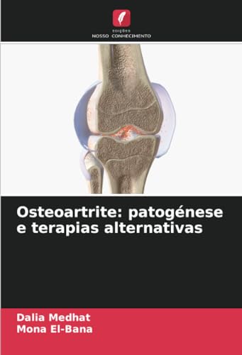 Osteoartrite: patogénese e terapias alternativas: DE von Edições Nosso Conhecimento