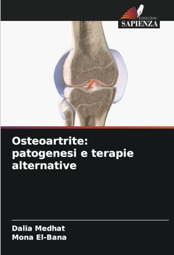 Osteoartrite: patogenesi e terapie alternative: DE von Edizioni Sapienza