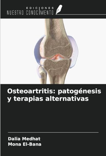 Osteoartritis: patogénesis y terapias alternativas von Ediciones Nuestro Conocimiento