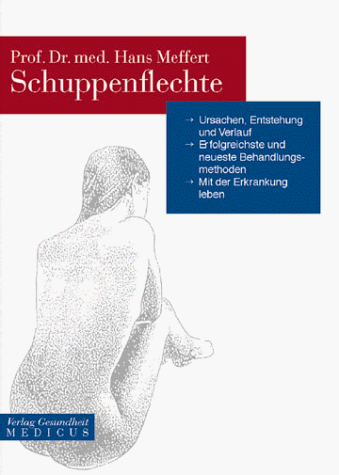 Schuppenflechte