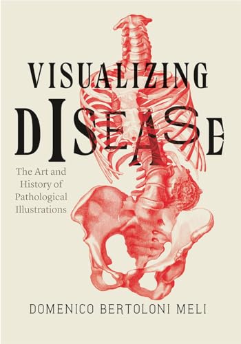Visualizing Disease: The Art and History of Pathological Illustrations von University of Chicago Press