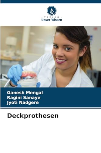 Deckprothesen von Verlag Unser Wissen