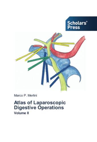 Atlas of Laparoscopic Digestive Operations: Volume II von Scholars' Press