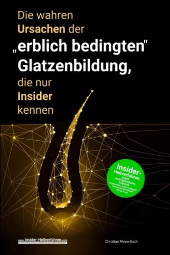 Die wahren Ursachen der "erblich bedingten" Glatzenbildung, die nur Insider kennen