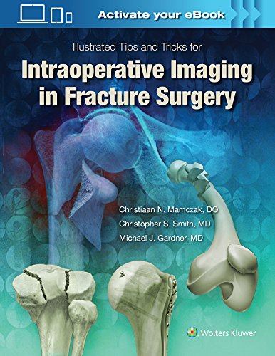 Illustrated Tips and Tricks for Intraoperative Imaging in Fracture Surgery von LWW