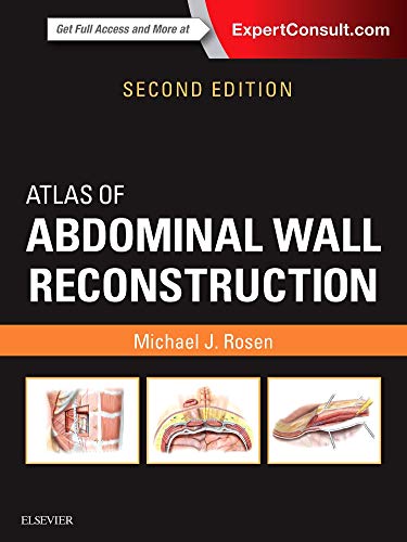 Atlas of Abdominal Wall Reconstruction: Expert Consult - Online and Print von Elsevier
