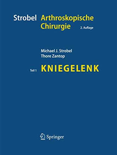 Strobel Arthroskopische Chirurgie: Teil I: Kniegelenk von Springer