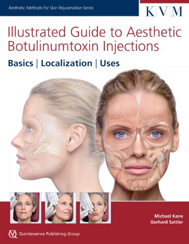 Illustrated Guide to Aesthetic Botulinumtoxin Injections: Basics | Localization | Uses (Aesthetic Methods for Skin Rejuvenation) von Quintessence Publishing (IL)