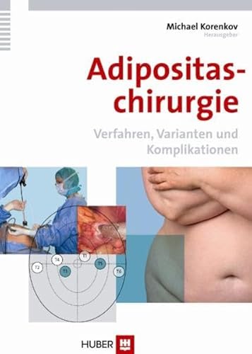 Adipositaschirurgie. Verfahren, Varianten und Komplikationen