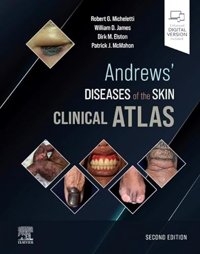 Andrews' Diseases of the Skin Clinical Atlas von Elsevier