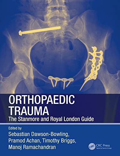 Orthopaedic Trauma: The Stanmore and Royal London Guide