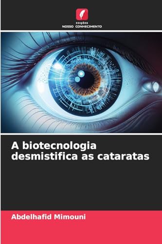 A biotecnologia desmistifica as cataratas A biotecnologia desmistifica as cataratas von Edições Nosso Conhecimento
