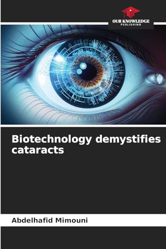 Biotechnology demystifies cataracts Biotechnology demystifies cataracts von Our Knowledge Publishing