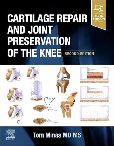Cartilage Repair and Joint Preservation of the Knee von Elsevier