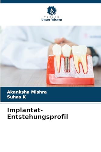 Implantat-Entstehungsprofil: DE von Verlag Unser Wissen