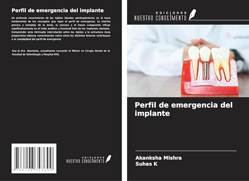 Perfil de emergencia del implante von Ediciones Nuestro Conocimiento