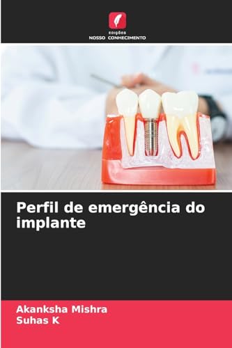 Perfil de emergência do implante von Edições Nosso Conhecimento