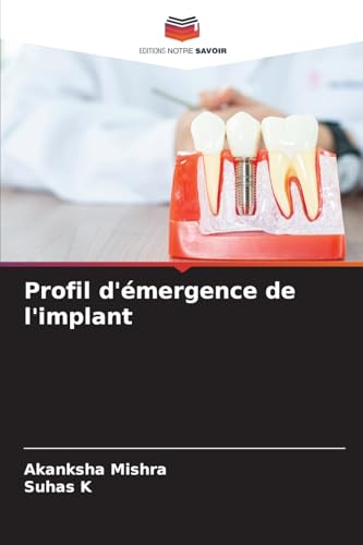 Profil d'émergence de l'implant von Editions Notre Savoir