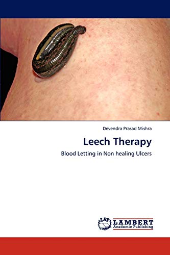 Leech Therapy: Blood Letting in Non healing Ulcers