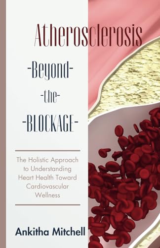 Atherosclerosis (Beyond the Blockage): The Holistic Approach to Understanding Heart Health Toward Cardiovascular Wellness von Independently published