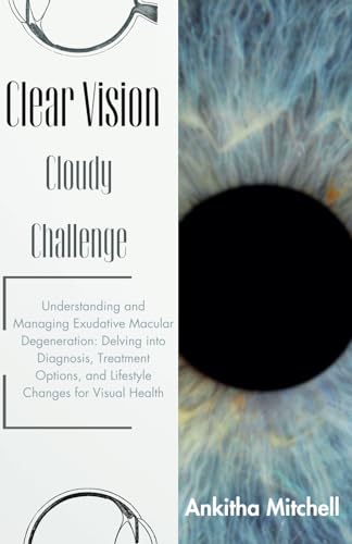 Clear Vision, Cloudy Challenge: Understanding and Managing Exudative Macular Degeneration: Delving into Diagnosis, Treatment Options, and Lifestyle Changes for Visual Health von Independently published