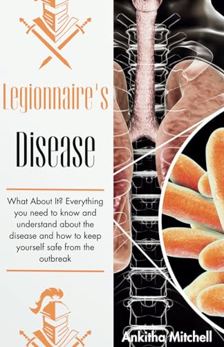 Legionnaire's Disease: What About It? Everything you need to know and understand about the disease and how to keep yourself safe from the outbreak von Independently published