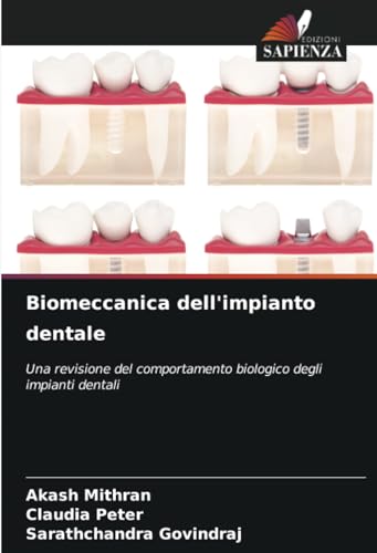 Biomeccanica dell'impianto dentale: Una revisione del comportamento biologico degli impianti dentali von Edizioni Sapienza