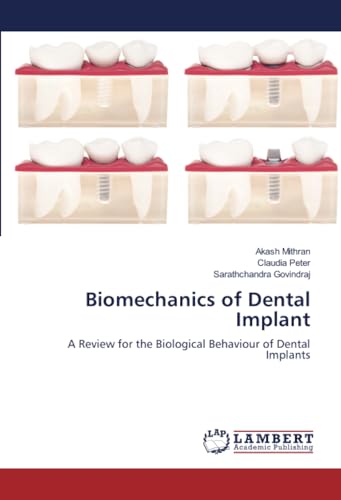 Biomechanics of Dental Implant: A Review for the Biological Behaviour of Dental Implants von LAP LAMBERT Academic Publishing