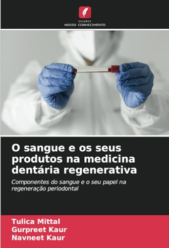 O sangue e os seus produtos na medicina dentária regenerativa: Componentes do sangue e o seu papel na regeneração periodontal von Edições Nosso Conhecimento