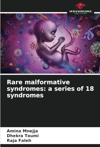 Rare malformative syndromes: a series of 18 syndromes: DE von Our Knowledge Publishing