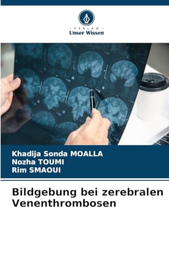 Bildgebung bei zerebralen Venenthrombosen von Verlag Unser Wissen