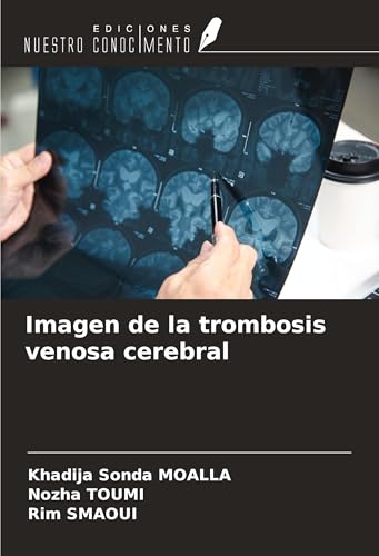 Imagen de la trombosis venosa cerebral von Ediciones Nuestro Conocimiento