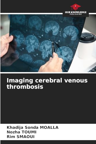 Imaging cerebral venous thrombosis von Our Knowledge Publishing