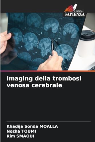 Imaging della trombosi venosa cerebrale von Edizioni Sapienza