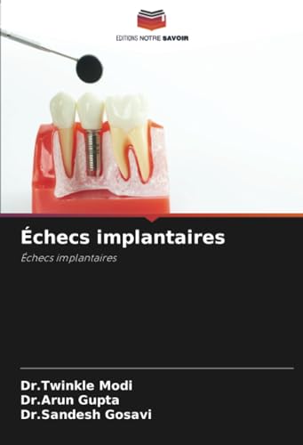 Échecs implantaires: Échecs implantaires von Editions Notre Savoir