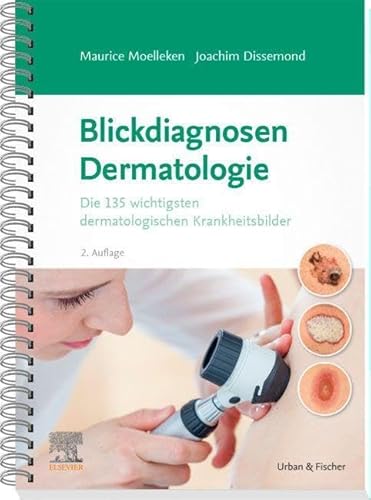 Blickdiagnosen Dermatologie: Die 135 wichtigsten dermatologischen Krankheitsbilder Blickdiagnosen Dermatologie: Die 135 wichtigsten dermatologischen Krankheitsbilder