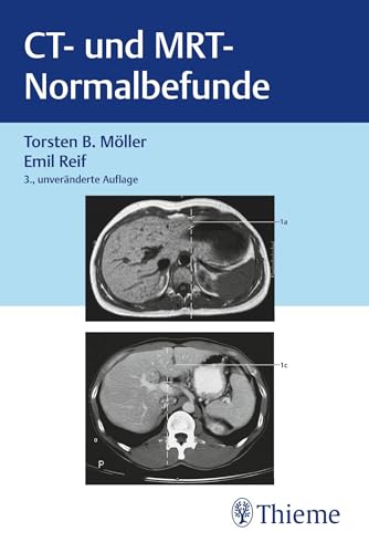 CT und MRT Normalbefunde von Thieme