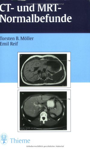CT und MRT Normalbefunde CT und MRT Normalbefunde